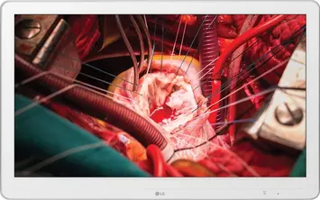 LG Medical 27HK510S-W, 27"